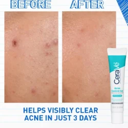 CeraVe Acne Control Gel 2% Salicylic Acid Pakistan